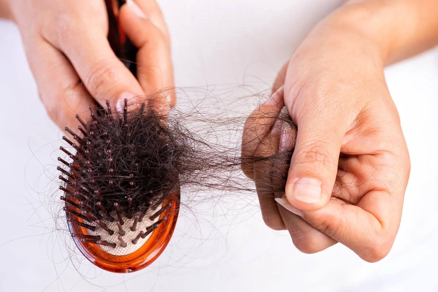 rambut rontok